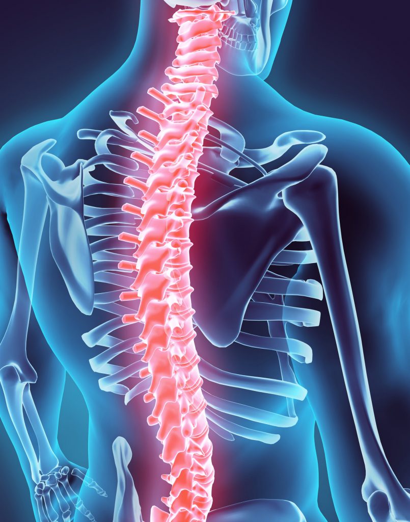 St. Joseph Spinal Cord Injuries Lawyer